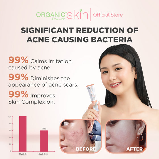 Organic Skin Japan Acne Care Dark Spot Correcting Cream 20ml Oil Control Anti Dark Spot Anti Acne
