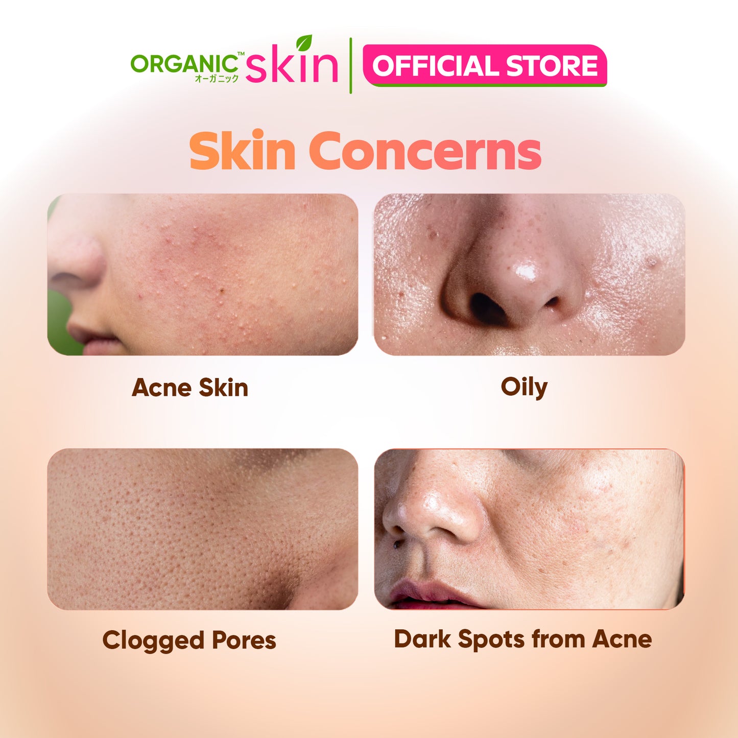 Organic Skin Japan Acne Care Dark Spot Correcting Cream 20ml Oil Control Anti Dark Spot Anti Acne