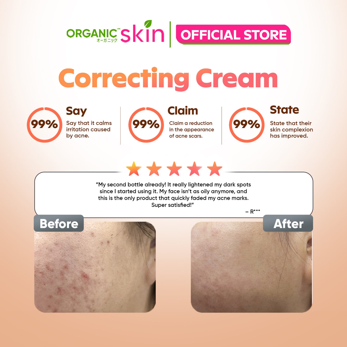 Organic Skin Japan Acne Care Dark Spot Correcting Cream 20ml Oil Control Anti Dark Spot Anti Acne