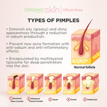 Load image into Gallery viewer, Organic Skin Japan Acne Care Dark Spot Correcting Cream 20ml Oil Control Anti Dark Spot Set of 2

