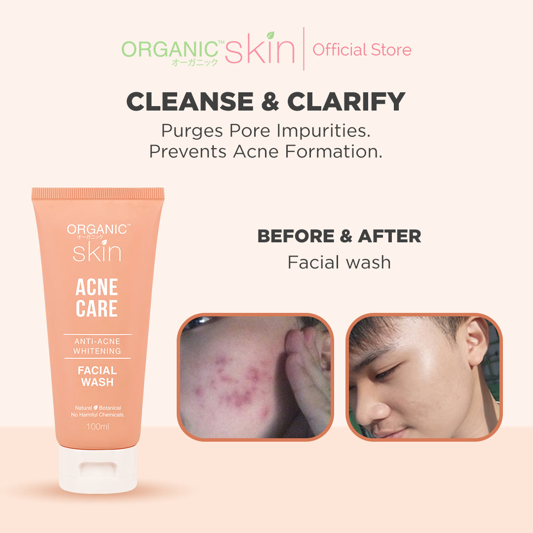 Organic Skin Japan Acne Care Antiacne Whitening Facial Wash Cleanser 100ml