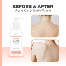 Load image into Gallery viewer, Organic Skin Japan Acne Care Bacne Body Wash 250ml Antiacne Bodywash
