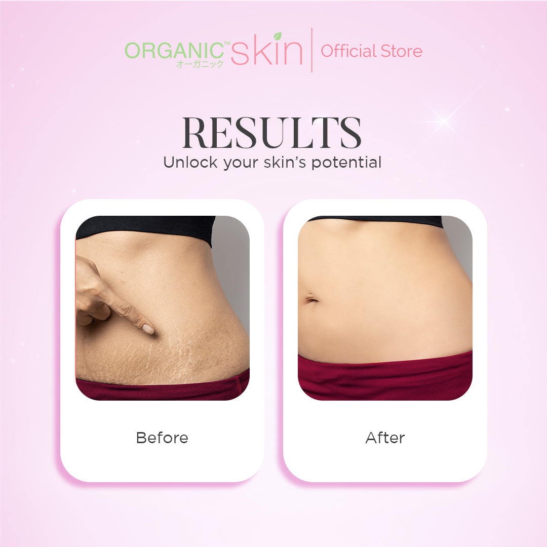 Organic Skin Japan Intimate Firming Massage Lotion for Stretch Marks 100ml Collagen Set of 2
