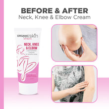 Load image into Gallery viewer, Organic Skin Japan Neck, Knee &amp; Elbow Lightening Cream 50ml Whitening cream
