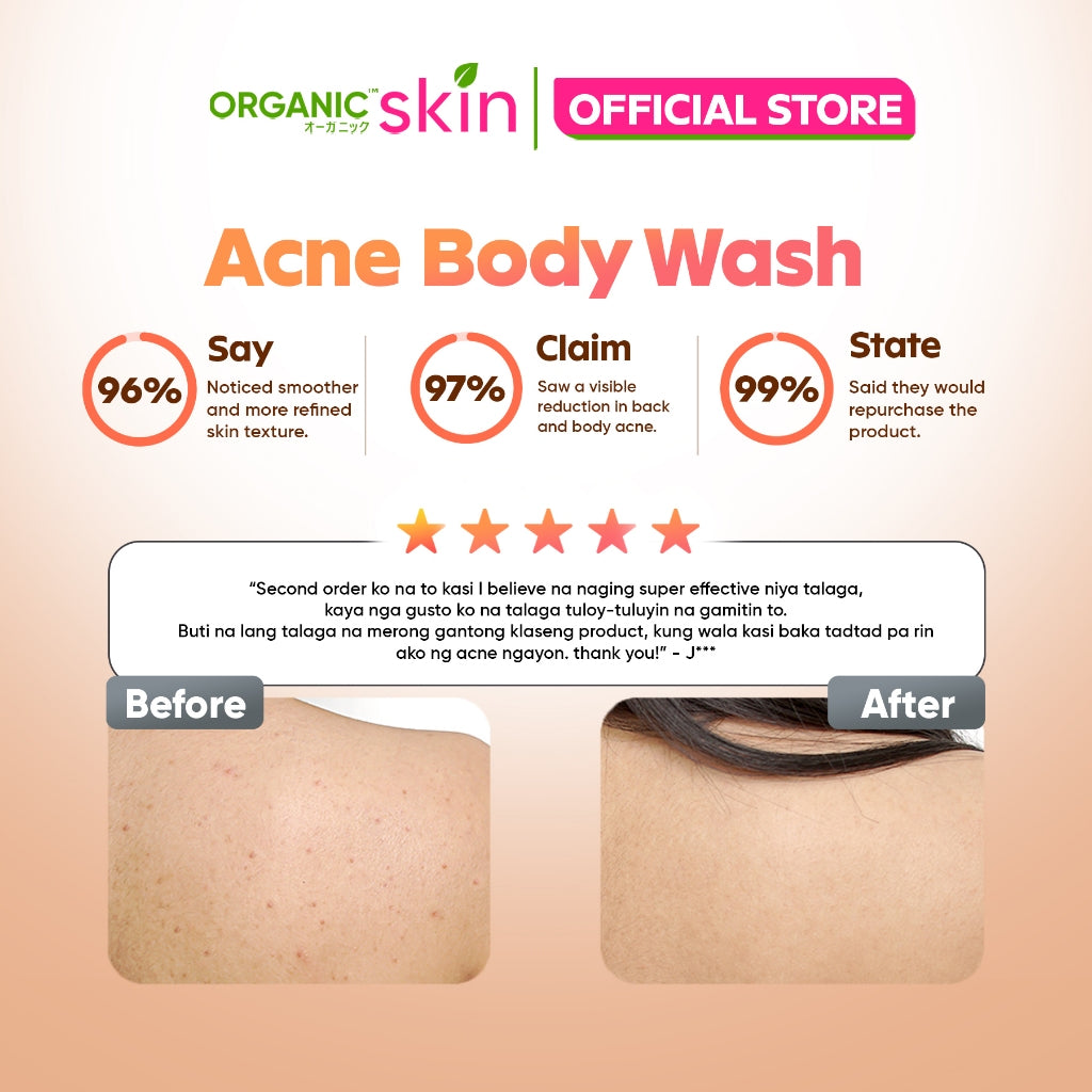 Organic Skin Japan Acne Care Bacne Body Wash 250ml Antiacne Bodywash