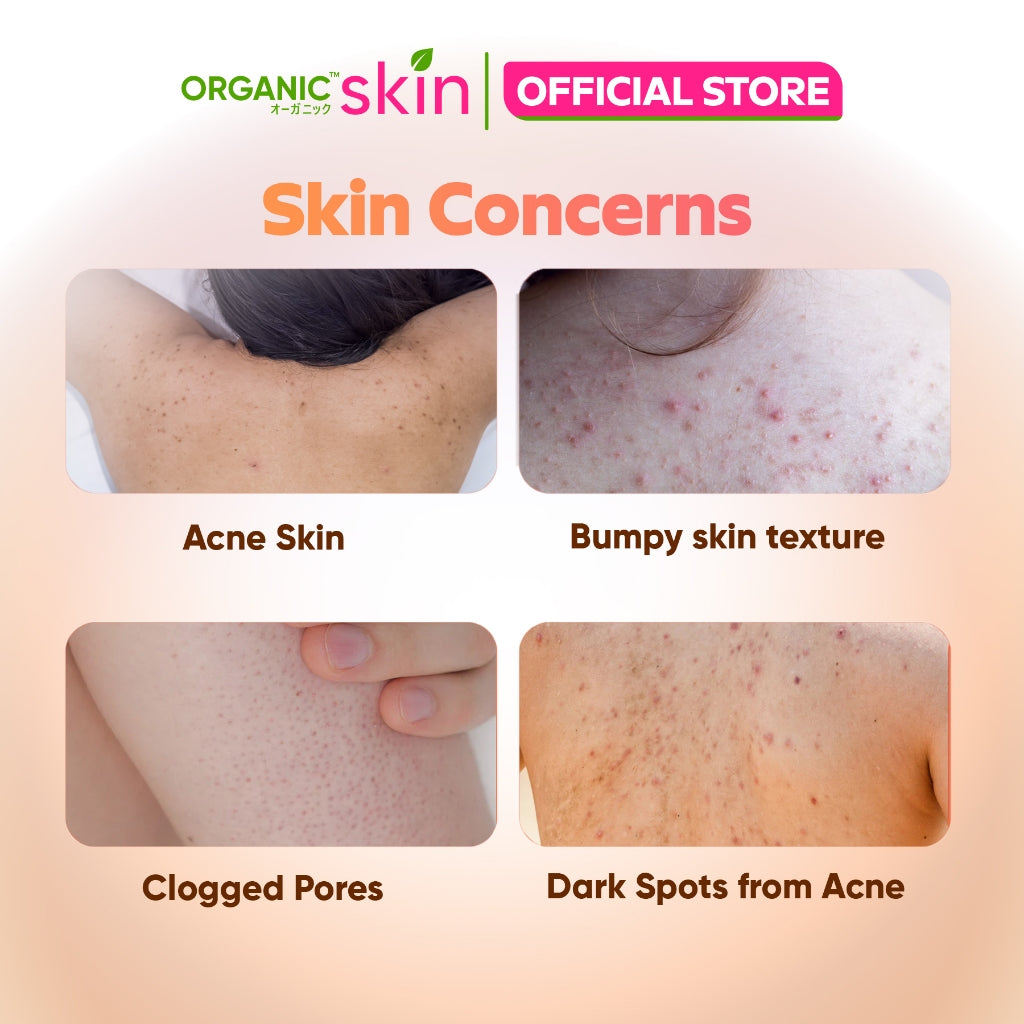 Organic Skin Japan Acne Care Set Bacne Body Wash 250ml & Zit Away Spray 100ml