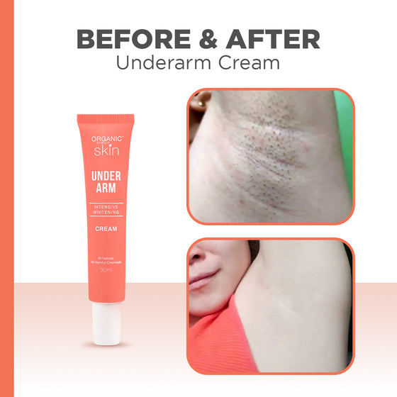Organic Skin Japan Intensive Underarm Whitening Cream (Set of 2, 30ml each)