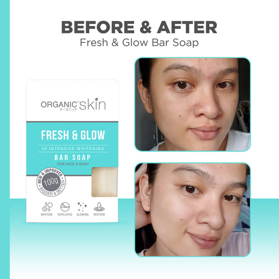 Organic Skin Japan 4x Whitening Soap with Kojic + Vitamin C (set of 2, 100g each)